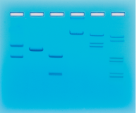 Restriction Enzyme Cleavage Patterns of DNA