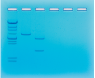 Size Determination of DNA Restriction Fragments