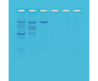 Analysis of Eco RI Cleavage Patterns of Lambda DNA