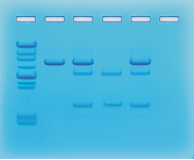 Cancer Gene Detection