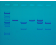 Cholesterol Diagnostics