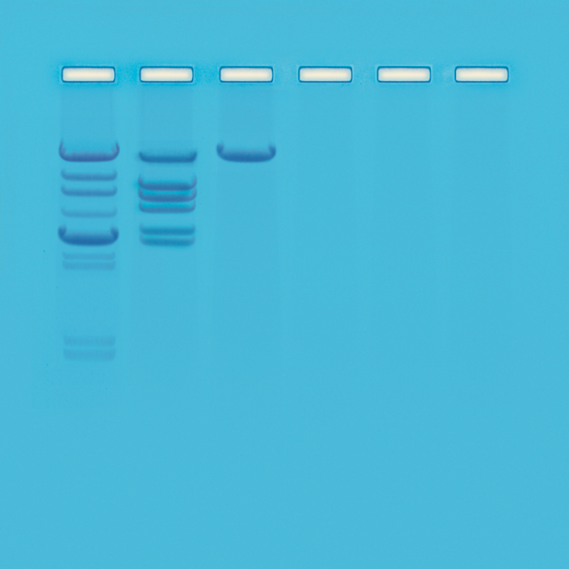 cleavage of lambda dna with eco ri an introduction to restriction enzymes biotek