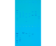 Cleavage of DNA Restriction Enzymes