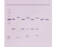DNA Fingerprinting: Southern Blot Analysis (Non-Isotopic Detection)