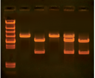 In Search of the Cholesterol Gene