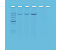 Isolation and Gel Analysis of DNA from Plants