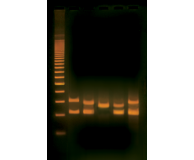 PCR-based VNTR Human DNA Typing (Adapted from FBI Technology)