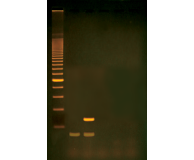 RT-PCR: A Model for the Molecular Biology of HIV Replication