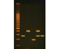 DNA Fingerprinting - Using PCR