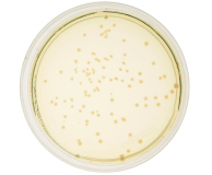 Transformation of E.coli with Plasmid pBR322