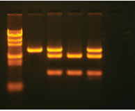 In Search of the Cancer Gene