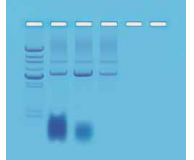 The Science of RNA: Extraction of Total RNA and Digestion by RNase