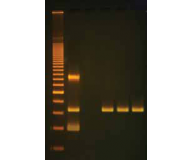 In Search of the Alcohol Gene