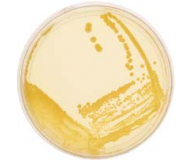 Anthrax- Biology of Bacterial Sporulation