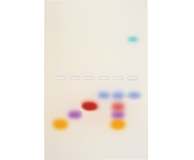Principles and Practice of Agarose Gel Electrophoresis