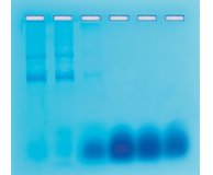 Separation of RNA & DNA by Gel Filtration Chromatography