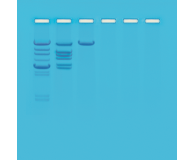 Cleavage of Lambda DNA with Eco RI: An Introduction to Restriction Enzymes