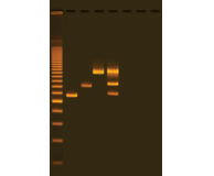 PCR-based Water Analysis