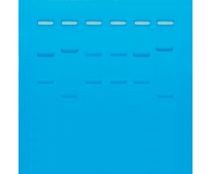 DNA Fingerprinting I: I.D. of DNA by Restriction Fragmentation Patterns