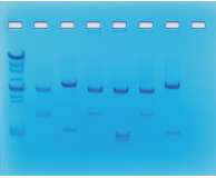 DNA Fingerprinting Using Restriction Enzymes