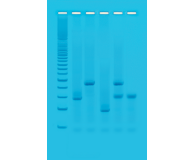 PCR-based DNA Fingerprinting