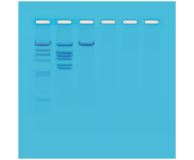 112- Restriction Enzyme Analysis of DNA