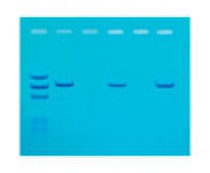 117- Detection of Mad Cow Disease
