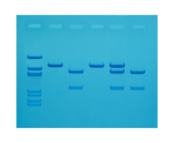 118- Cholesterol Diagnostics
