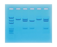 123- Nucleic Acid testing for COVID-19