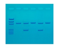 122- Detection of the Influenza Virus