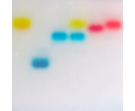 Simulations of DNA Electrophoresis