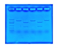 135- Using CRISPR To Treat Cystic Fibrosis